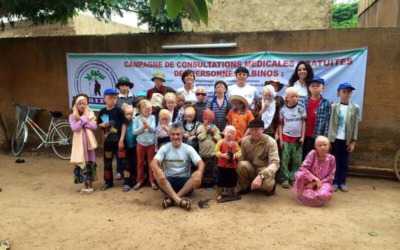 Proyecto Burkina Albinos